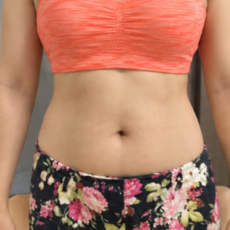 Weight wellness programme progress at week 4 — waistline after four weeks of care at HIRAYA Lifestyle Clinic
